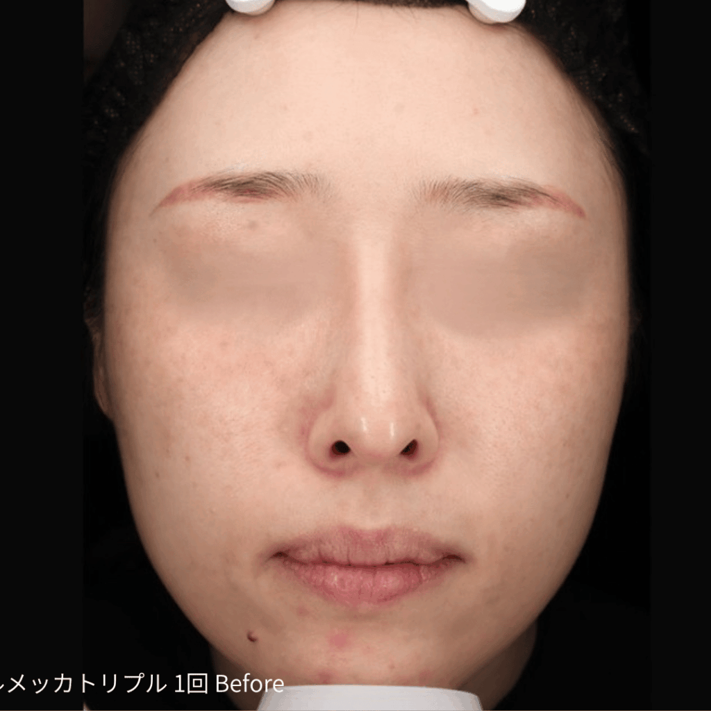 ルメッカ