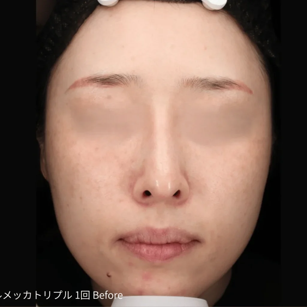 ルメッカ