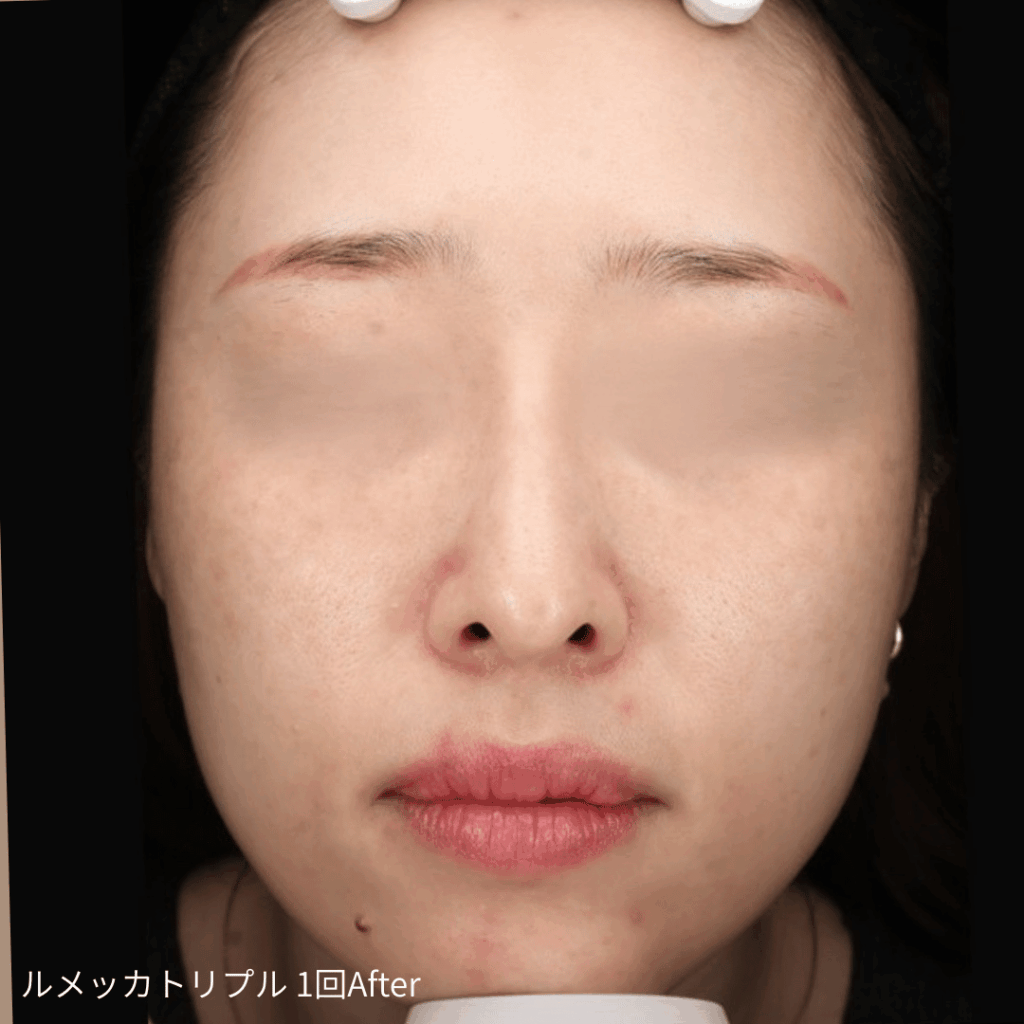 ルメッカ