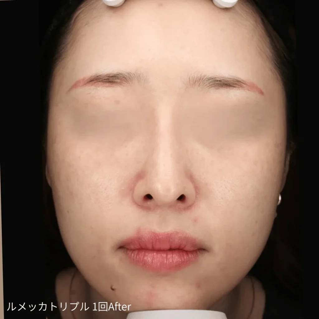 ルメッカ