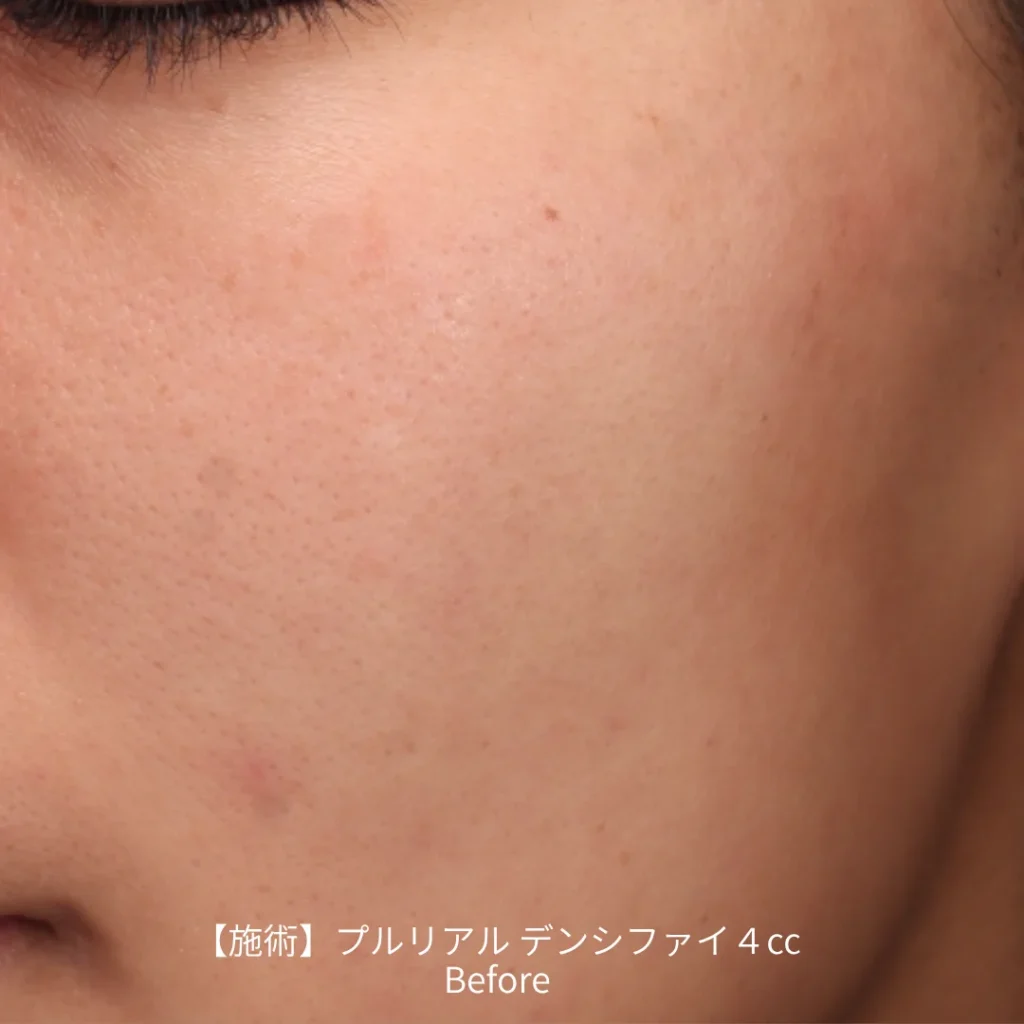 プルリアルデンシファイ 手打ち