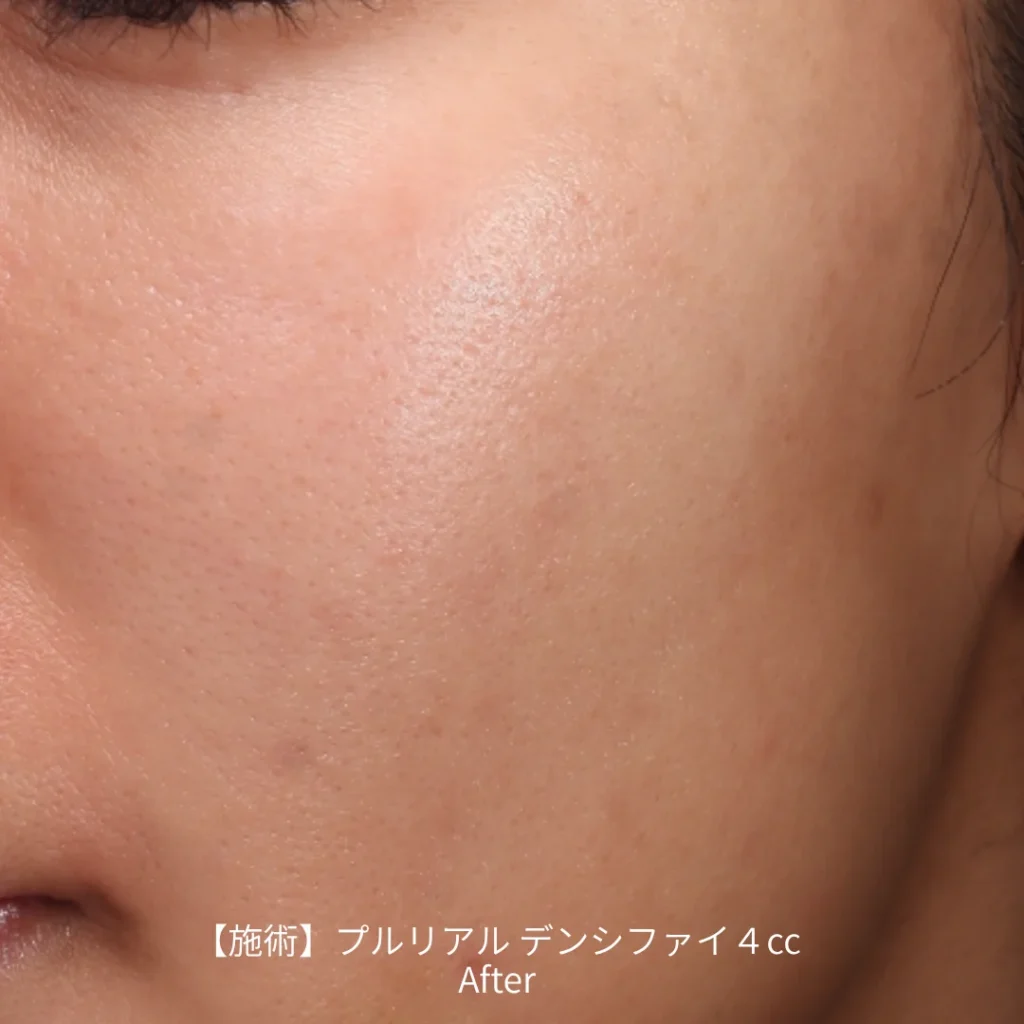 プルリアルデンシファイ 手打ち