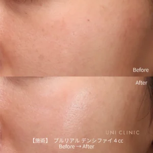 プルリアルデンシファイ 手打ち